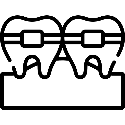 Meratakan Gigi (Ortho)
